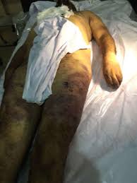 Aftab Ahmed Torture